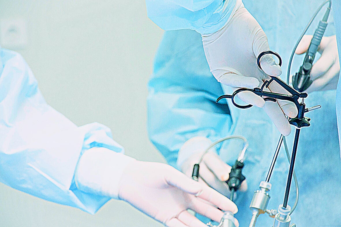 Surgeon performs laparoscopic surgery on the abdomen. Close-up of a laparoscope and doctor's hands